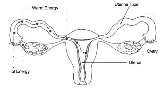 ovarian
